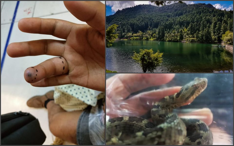 Joven es mordido por una serpiente de cascabel durante paseo en El Cedral; tuvo que ir al hospital