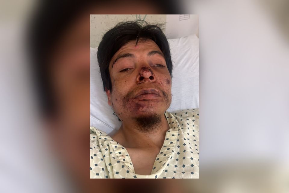 Efraín se encuentra hospitalizado en Pachuca; piden ayuda para encontrar a sus familiares