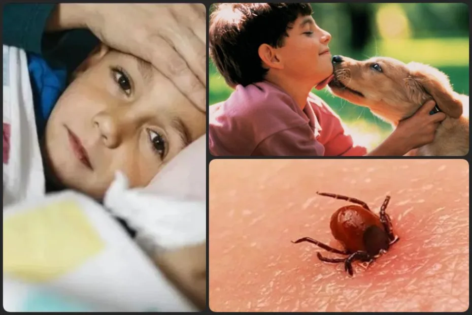 ¿Qué es la rickettsiosis? Secretaría de Salud advierte incremento de contagios en Hidalgo