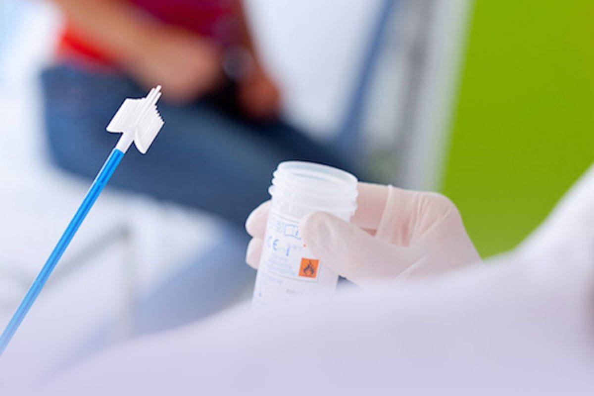 Ofrecen estudios gratuitos en Pachuca para prevenir el cáncer cervicouterino