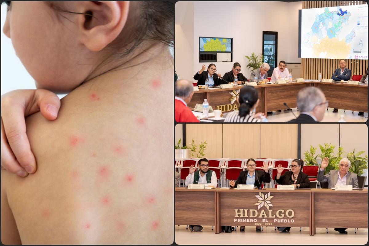 Implementan medidas urgentes ante riesgo real de reintroducción del sarampión en Hidalgo