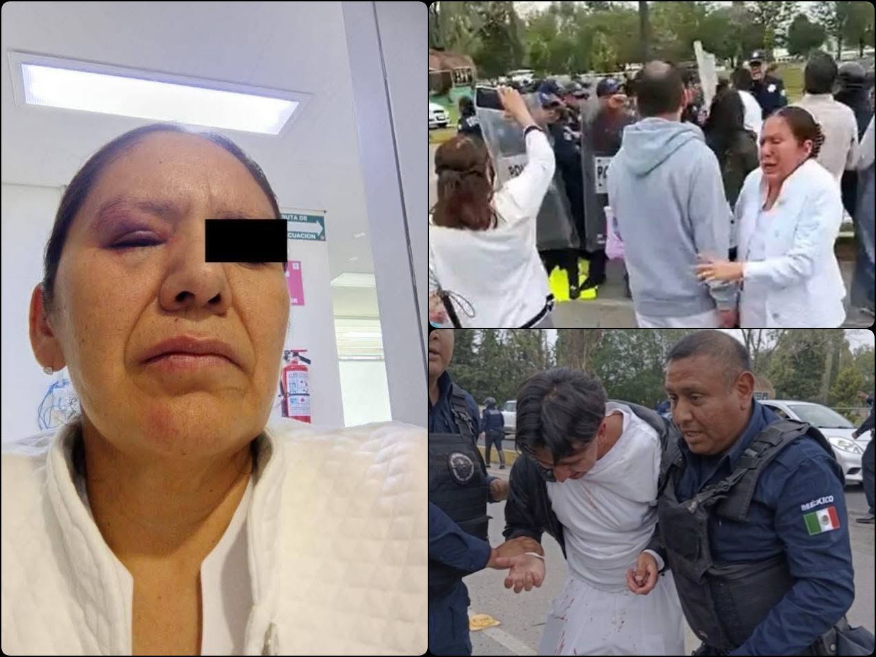Denuncial abuso policial tras protesta de trabajadores del ISSSTE